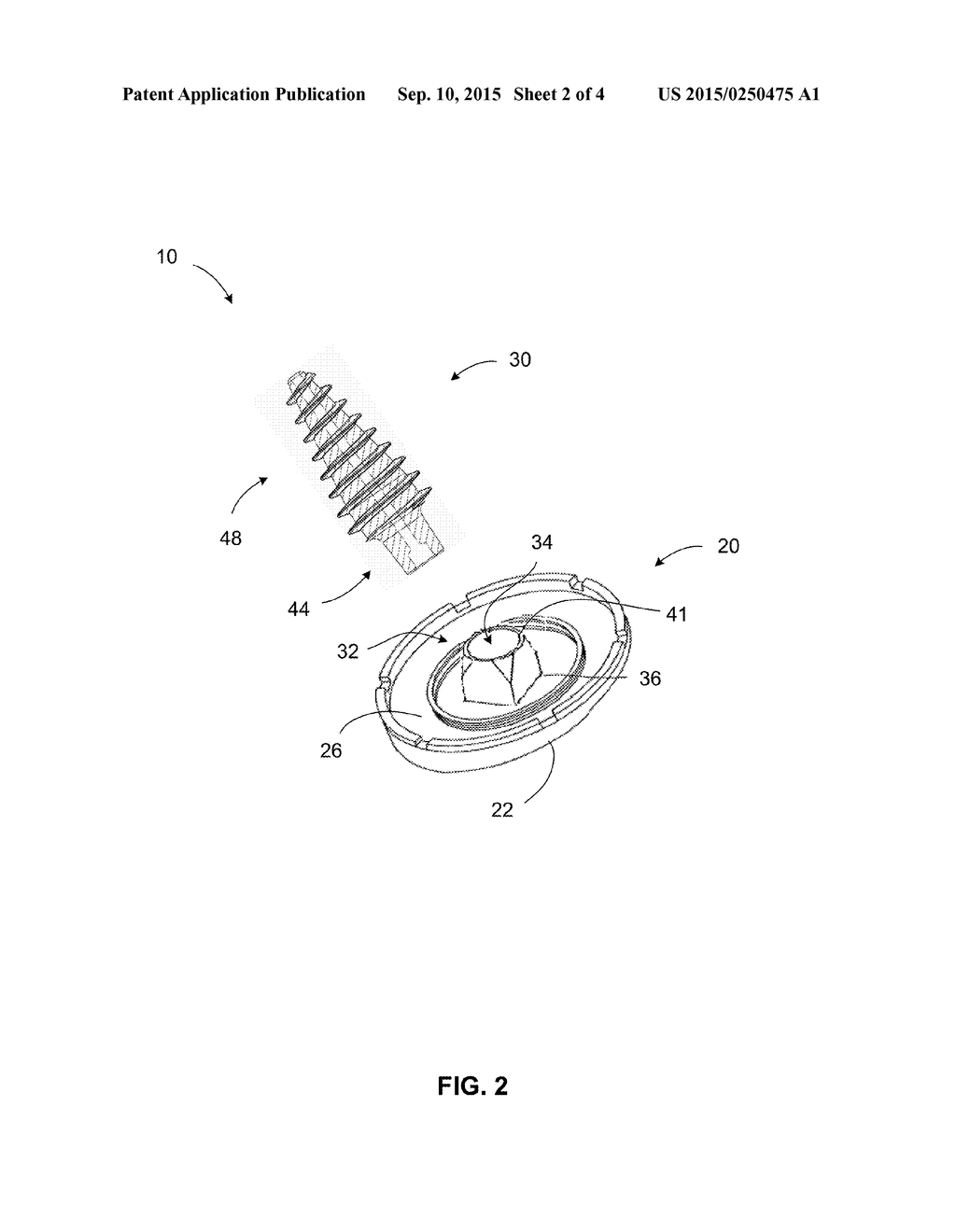 Anchor for an Implant Assembly - diagram, schematic, and image 03