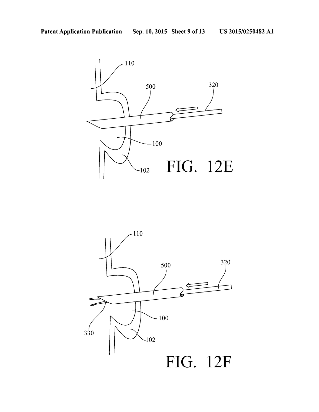 ATRIAL APPENDAGE CLOSURE DEVICE AND RELATED METHODS - diagram, schematic, and image 10