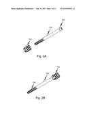 SYNDESMOSIS SCREW diagram and image