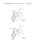 Locking and Lagging Bone Screws diagram and image