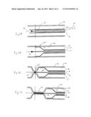 METHOD FOR TREATING VARICOSE VEINS AND INTRALUMINAL DEVICE USED IN SUCH     METHOD diagram and image