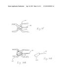 METHOD FOR TREATING VARICOSE VEINS AND INTRALUMINAL DEVICE USED IN SUCH     METHOD diagram and image