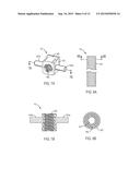 FUSING AND CUTTING SURGICAL INSTRUMENT AND RELATED METHODS diagram and image