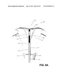 SYSTEM AND METHOD FOR ENDOMETRIAL ABLATION diagram and image