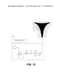 SYSTEM AND METHOD FOR ENDOMETRIAL ABLATION diagram and image