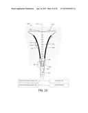 SYSTEM AND METHOD FOR ENDOMETRIAL ABLATION diagram and image