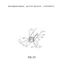 SYSTEM AND METHOD FOR ENDOMETRIAL ABLATION diagram and image