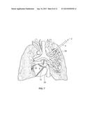 METHODS OF COAGULATING TISSUE diagram and image