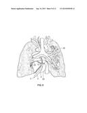 METHODS OF COAGULATING TISSUE diagram and image