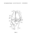 METHODS OF COAGULATING TISSUE diagram and image