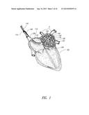 MEDICAL DEVICE FOR USE IN BODILY LUMENS, FOR EXAMPLE AN ATRIUM diagram and image