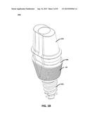 ECCENTRIC DENTAL IMPLANT SYSTEM diagram and image