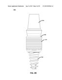 ECCENTRIC DENTAL IMPLANT SYSTEM diagram and image