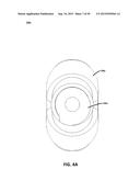 ECCENTRIC DENTAL IMPLANT SYSTEM diagram and image