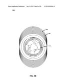 ECCENTRIC DENTAL IMPLANT SYSTEM diagram and image