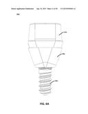 ECCENTRIC DENTAL IMPLANT SYSTEM diagram and image