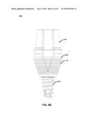 ECCENTRIC DENTAL IMPLANT SYSTEM diagram and image