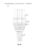 ECCENTRIC DENTAL IMPLANT SYSTEM diagram and image