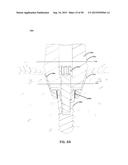 ECCENTRIC DENTAL IMPLANT SYSTEM diagram and image