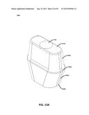 ECCENTRIC DENTAL IMPLANT SYSTEM diagram and image