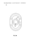 ECCENTRIC DENTAL IMPLANT SYSTEM diagram and image