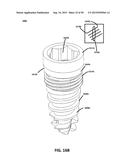 ECCENTRIC DENTAL IMPLANT SYSTEM diagram and image