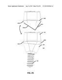 ECCENTRIC DENTAL IMPLANT SYSTEM diagram and image