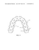 Dental Device diagram and image