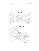 SELF-ANCHORING SLING AND INTRODUCER SYSTEM diagram and image