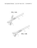 SELF-ANCHORING SLING AND INTRODUCER SYSTEM diagram and image