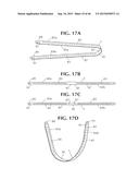 SELF-ANCHORING SLING AND INTRODUCER SYSTEM diagram and image