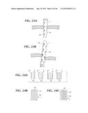 SELF-ANCHORING SLING AND INTRODUCER SYSTEM diagram and image