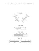 SELF-ANCHORING SLING AND INTRODUCER SYSTEM diagram and image