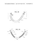 SELF-ANCHORING SLING AND INTRODUCER SYSTEM diagram and image