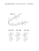 SELF-ANCHORING SLING AND INTRODUCER SYSTEM diagram and image