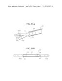 SELF-ANCHORING SLING AND INTRODUCER SYSTEM diagram and image