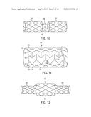 BISTABLE SPRING CONSTRUCTION FOR A STENT AND OTHER MEDICAL APPARATUS diagram and image