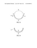 BISTABLE SPRING CONSTRUCTION FOR A STENT AND OTHER MEDICAL APPARATUS diagram and image