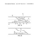 BISTABLE SPRING CONSTRUCTION FOR A STENT AND OTHER MEDICAL APPARATUS diagram and image