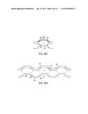 BISTABLE SPRING CONSTRUCTION FOR A STENT AND OTHER MEDICAL APPARATUS diagram and image