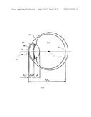 INTRAOCULAR LENS THAT IMPROVES OVERALL VISION WHERE THERE IS A LOCAL LOSS     OF RETINAL FUNCTION diagram and image