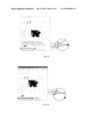 INTRAOCULAR LENS THAT IMPROVES OVERALL VISION WHERE THERE IS A LOCAL LOSS     OF RETINAL FUNCTION diagram and image