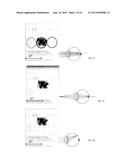 INTRAOCULAR LENS THAT IMPROVES OVERALL VISION WHERE THERE IS A LOCAL LOSS     OF RETINAL FUNCTION diagram and image