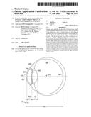 ENHANCED TORIC LENS THAT IMPROVES OVERALL VISION WHERE THERE IS A LOCAL     LOSS OF RETINAL FUNCTION diagram and image