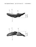 AURICULAR IMPLANT diagram and image