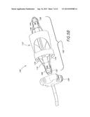 METHODS FOR DEPLOYING SELF-EXPANDING HEART VALVES diagram and image