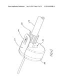 METHODS FOR DEPLOYING SELF-EXPANDING HEART VALVES diagram and image