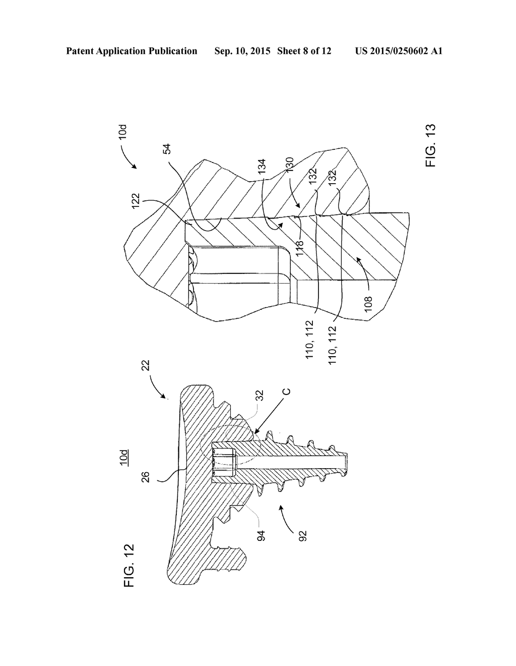 IMPLANT AND ANCHOR ASSEMBLY - diagram, schematic, and image 09