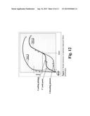 Wave Spring for a Spinal Implant diagram and image