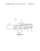 VASCULAR IMPLANT WITH SIDE BRANCH diagram and image